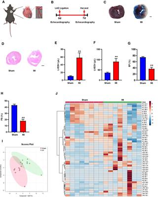 Metabolic changes of glycerophospholipids during the reparative phase after myocardial infarction injury